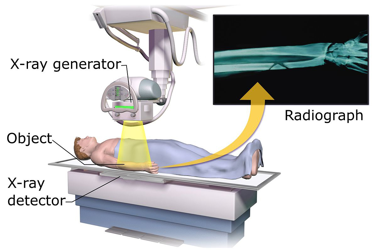 image X-rays