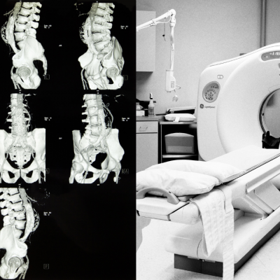 Ct Scan